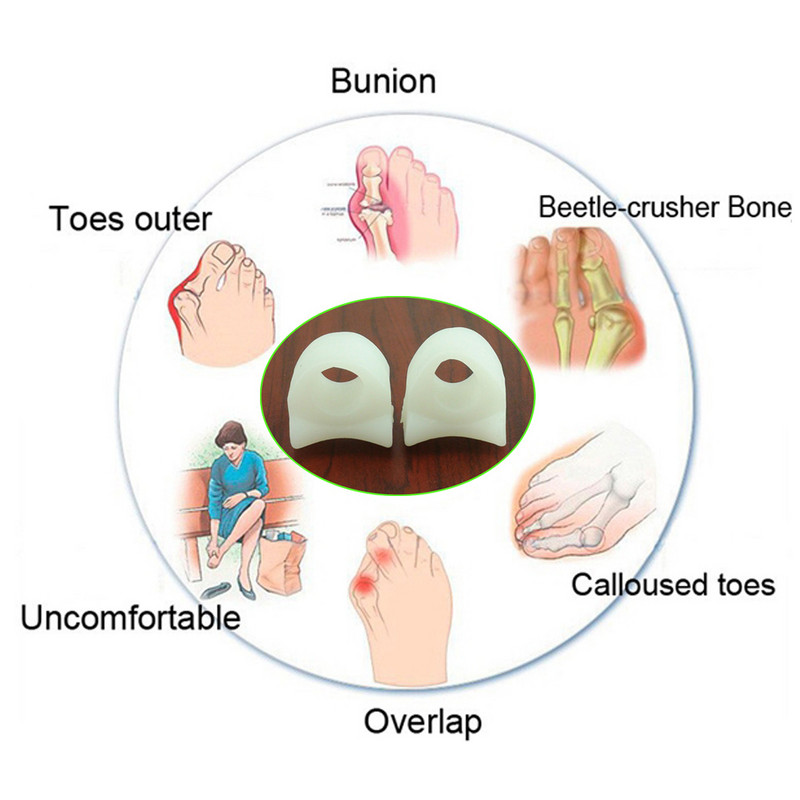2db=1pár szilikon gél nagylábujj elválasztó bunion állító lábujjak protektor Csont Hallux Valgus Corrector lábápoló pedikűr
