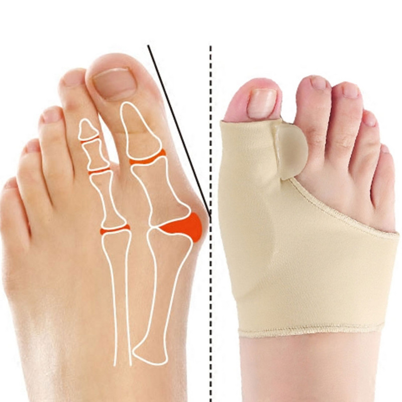 2tk=1paar varvaste eraldaja Hallux Valgus Bunion Corrector Orthotics Jalad Luu Pöidla Adjuster Korrektsioon Pediküür Soki Sirgendaja