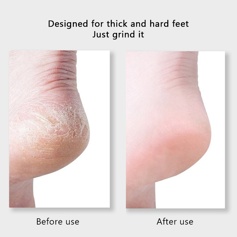 Pedichiură Pilă pentru picior Îndepărtează calusuri Racătoare pentru picioare din oțel inoxidabil Râzlă portabilă Răzătoare pentru picioare Colossal Scrubber Pro pentru picioare umede/uscate