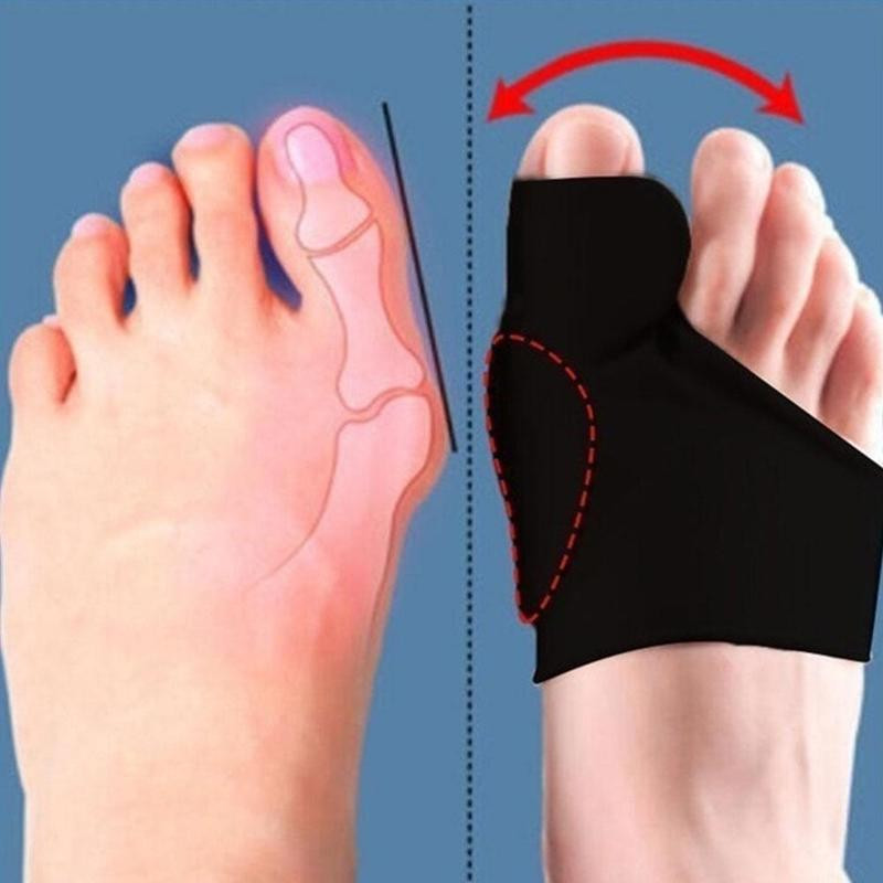 2vnt Bunion Corrector Hallux Valgus Corrector pirštų atskyrikliai pedikiūro įrankis Bone Nykštys Ortopedinės petnešos pėdos apsaugos įtvaras