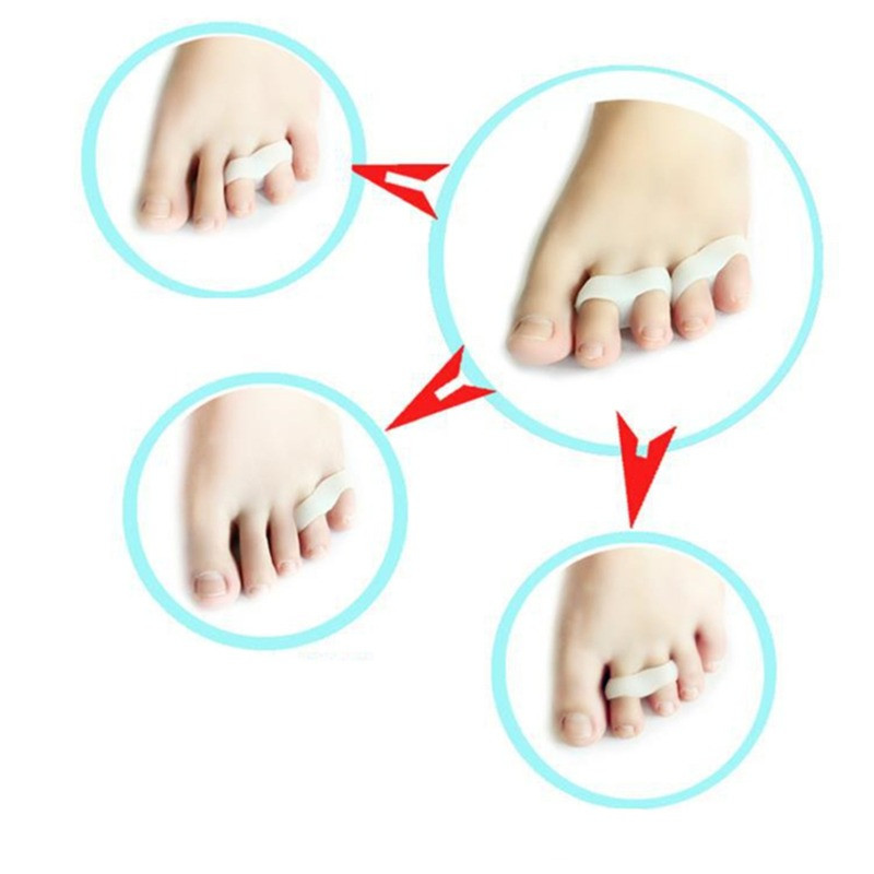 1Pair Hallux Valgus silikono korekcinis gelis pėdų priežiūros pirštų atskyriklis Little Finger Protector Bunion Adjuster Protetor Joanete