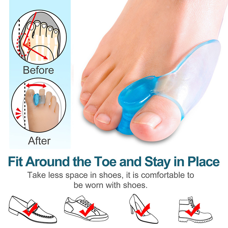 1Pár lábujjak elválasztó Ortózis Láb Csont Hüvelykujj-beállító Korrekció Hallux Valgus Bunion Corrector Pedikűr Szilikon Hajegyenesítő