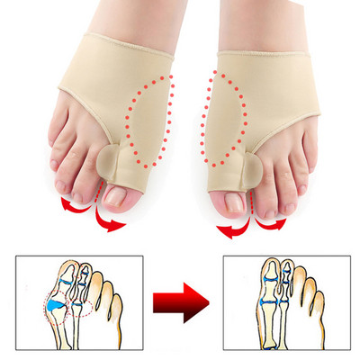 2 db Bunion Corrector Gel Pad Stretch Nylon Hallux Valgus Protector Guard lábujjleválasztó ortopédiai kellékek
