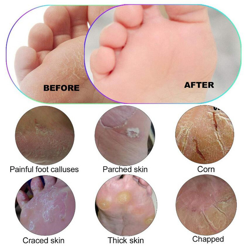 1 ks pilník na nohy, pedikúra, kefa z nehrdzavejúcej ocele, drhnutie päty, odstraňovač odumretej kože, exfoliačný profesionálny nástroj na starostlivosť o nohy