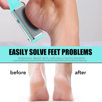 Heel Clean Pedicure Tools Callus Remover Foot Scrubber Foot Scrubber File and Callus Remover Feet Massage Brush Manicure Foot Care Tools