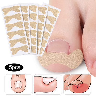 Bunion Corrector įaugusių kojų nagų korektorius Lipdukas paronichijos gydymui Fixer Recover bunion Pedikiūras Pėdų kojų pirštų nagų priežiūros priemonė