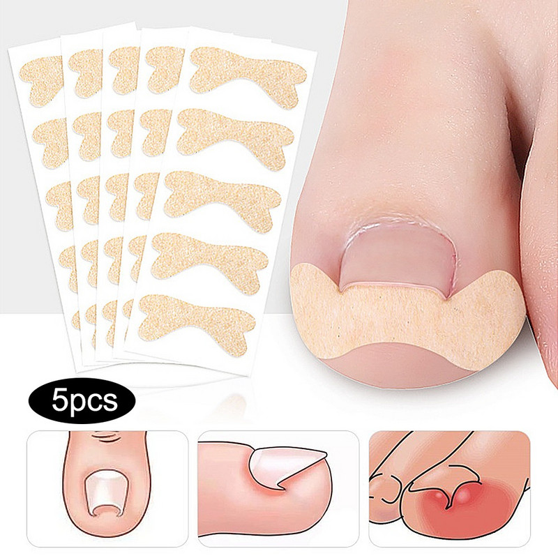 Bunion Corrector įaugusių kojų nagų korektorius Lipdukas paronichijos gydymui Fixer Recover bunion Pedikiūras Pėdų kojų pirštų nagų priežiūros priemonė