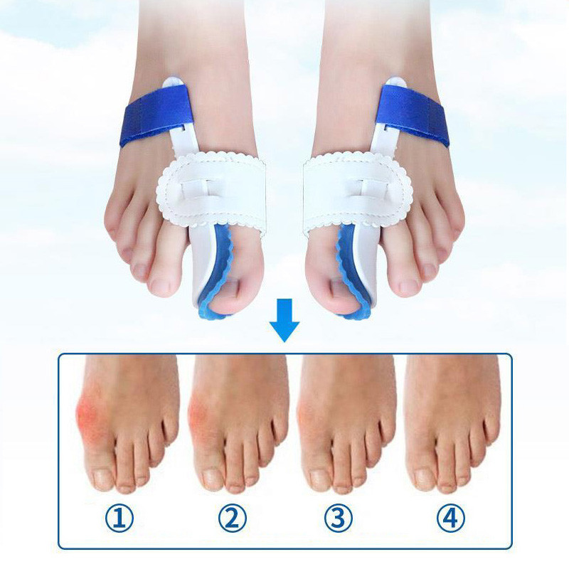 1 pora universalaus naktinio naudojimo Big Toe Bunion Device įtvaro tiesintuvo Hallux Valgus Pro petnešos pirštų korekcijos skyriklis