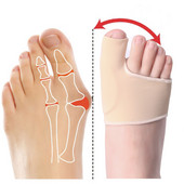 2db=1páros lábujjkorrektor Orthotics Láb Lábápolás Csont Hüvelykujj-beállító Korrekció Egészséges Puha Pedikűr Zokni Búni Hajegyenesítő