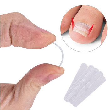 Педикюр Инструмент за корекция на ноктите на пръстите на крака Лечение на ноктите Еластична лепенка Стикер Изправяща скоба Инструменти за грижа за краката