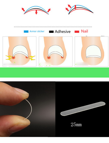 Педикюр Инструмент за корекция на ноктите на пръстите на крака Лечение на ноктите Еластична лепенка Стикер Изправяща скоба Инструменти за грижа за краката
