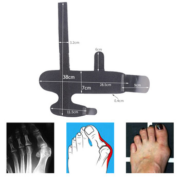 1Pcs Bunion Splint Toe Straightener & Corrector Brace Pad за Hallux Valgus Облекчаване на болката - Ден Нощна поддръжка за мъже и жени