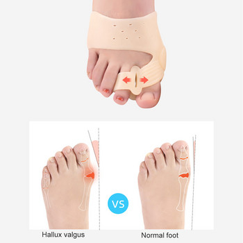 1 чифт коректор за облекчаване на бунион за жени, мъже, разделител на пръстите на краката, изправяне на пръстите на халукс валгус и облекчаване на болки в ставите на големите пръсти