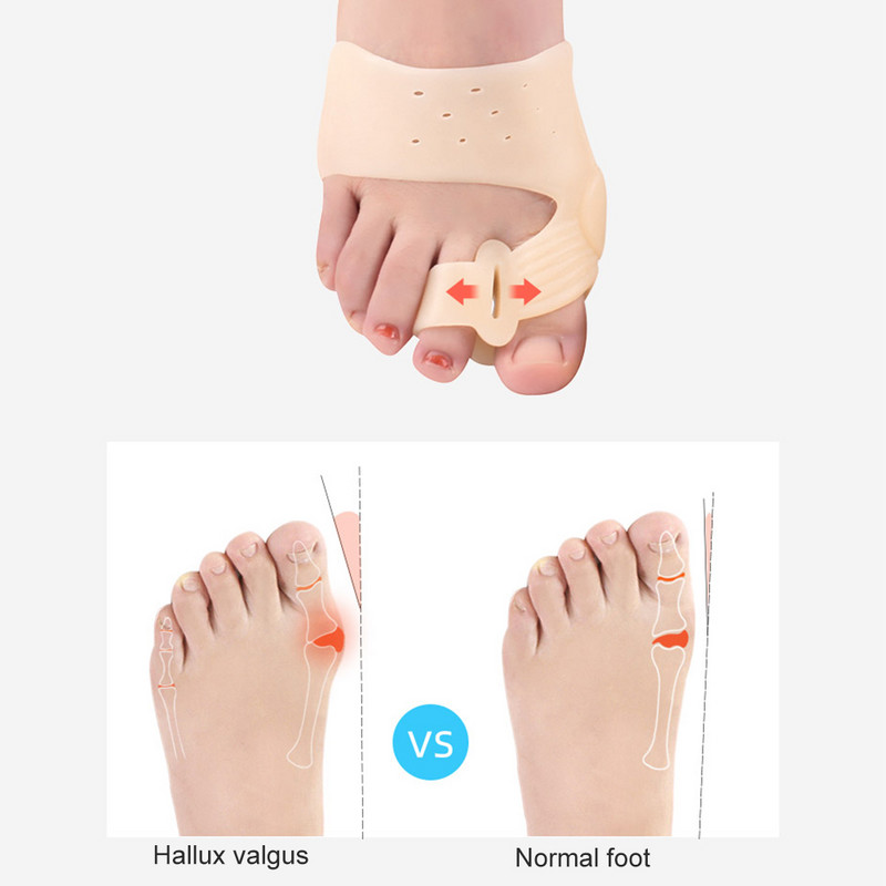 1Pair Bunion Corrector Relief Moterys Vyrams, Didžiųjų Kojų pirštų Atskyrimo Pirštų Tiesintuvas Hallux Valgus ir Didžiųjų Kojų Sąnarių Skausmui malšinti