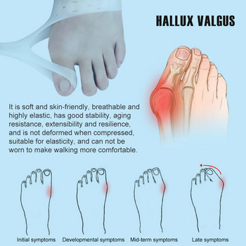 1 Pair Silicone Bunion Corrector Relief, Big Separator Toe Straighter for Hallux Valgus and Big Toe Join Pain Relief