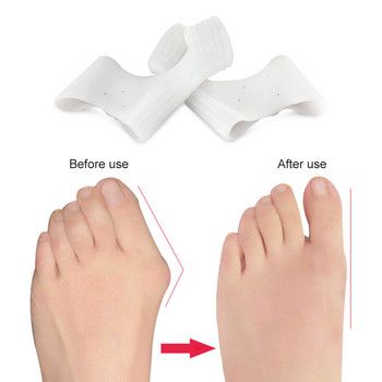 1 Pair Silicone Bunion Corrector Relief, Big Separator Toe Straighter for Hallux Valgus and Big Toe Join Pain Relief