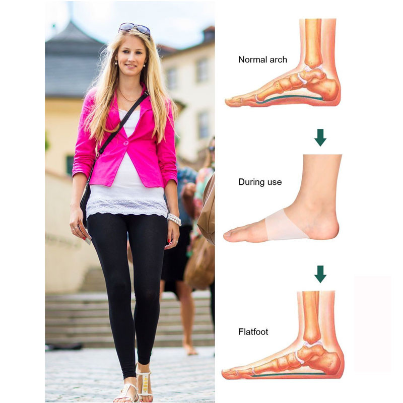 1paar geelvõlvi toetavad pehmed varrukad, polsterdus, kiire valu leevendamine lameda jala jalatalla fastsiidi korral, kanna kannused langenud ja kõrged võlvid
