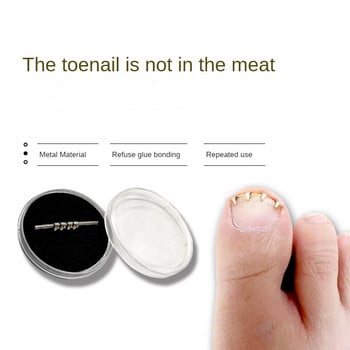 1PCS Professional Ingrown Toe Nail Correction Wire Fixer Treatment Pedicure Paronychia Recover Nails Corrector Επαναχρησιμοποιήσιμο