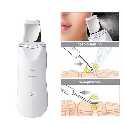 Ultrahangos bőrradír tisztító arctisztító akne eltávolító arcmasszírozó ultrahangos peeling tiszta tónus emelő arceszköz