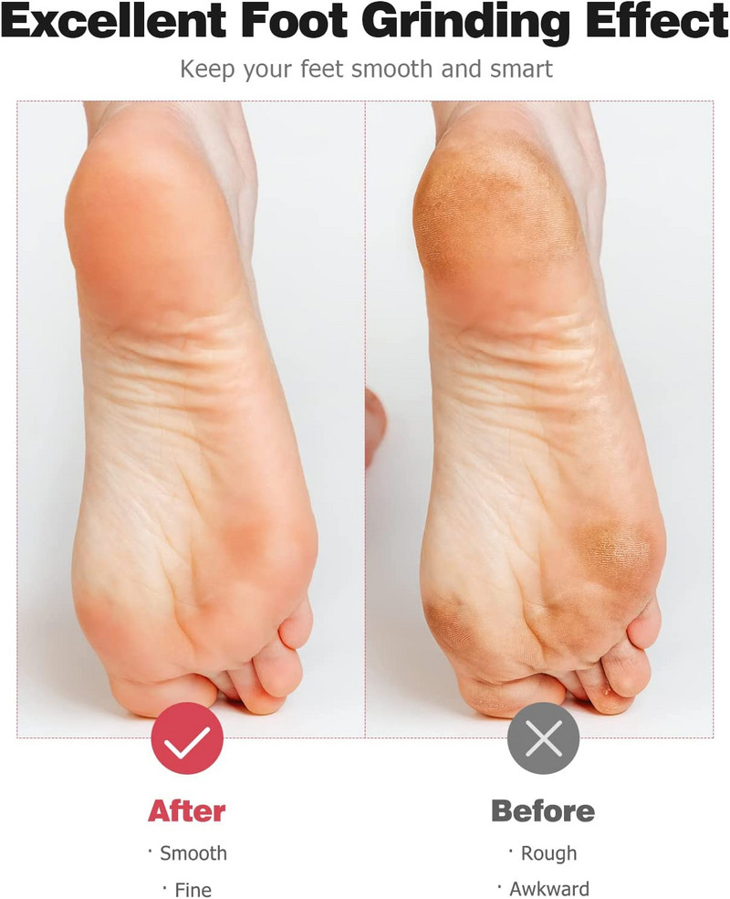 10/5 buc. Cap role de reumplere de schimb extra grosier, gri închis, pentru pedichiură electrică, instrumente pentru picior, accesorii pentru instrumente de îngrijire a picioarelor