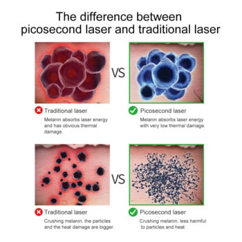 Лесколтън Пикосекундна лазерна писалка Терапия със синя светлина Татуировка Бенка Премахване на лунички Машина за премахване на тъмни петна Уреди за красота Домашна употреба