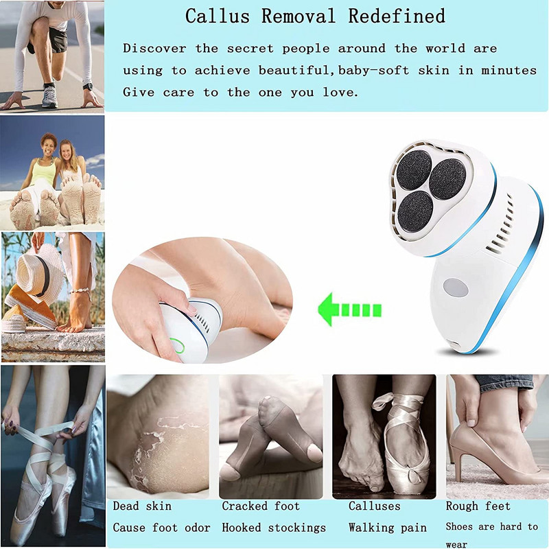 Râpă electrică pentru picioare Râpă electrică anti-calus cu 6 role și 2 viteze - Reîncărcabilă prin USB, impermeabilă, pentru îngrijirea picioarelor.