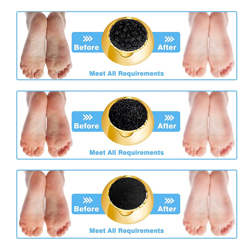 Új elektromos pedikűr sima bőrkeményedés eltávolító USB töltőtalp sarokcsiszoló reszelőkhöz, hordozható tiszta ápolószer