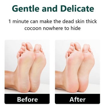 Electric Foot File Vacuum Callus Remover Rechargeable Absorbing Machine Dead hard Skin Dead hard Skin Callus Remover Foot Polisher Pedicure 2