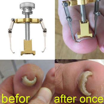 Σετ εργαλείων διόρθωσης νυχιών ποδιών Ingrown Treatment Fixer Recover Patch Pedicure File Nail Corrector Foot Care Kit