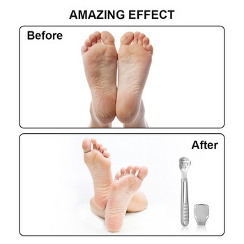 Foot Callus Shaver Heel Hard Skin Remover Χέρι Πόδια πεντικιούρ ξυραφάκι Εργαλείο ξυρίσματος Ξυριστικές λαβές από ανοξείδωτο ατσάλι Φορητό εργαλείο περιποίησης ποδιών