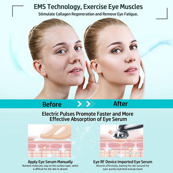 Συσκευή μικρορευμάτων προσώπου ραδιοσυχνοτήτων ραδιοσυχνοτήτων Eye Skin Tighten & Anti Aging Μηχάνημα μειώνει τις ρυτίδες Face Lifting Eyes Massager