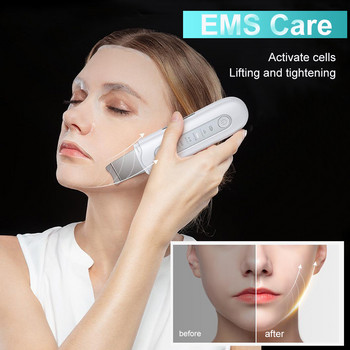Ultrasonic Skin Skin Head Remover Deep Face Cleaning Machine Deeling Shovel Removal Facial Pore Scrubber Cleaner Beauty