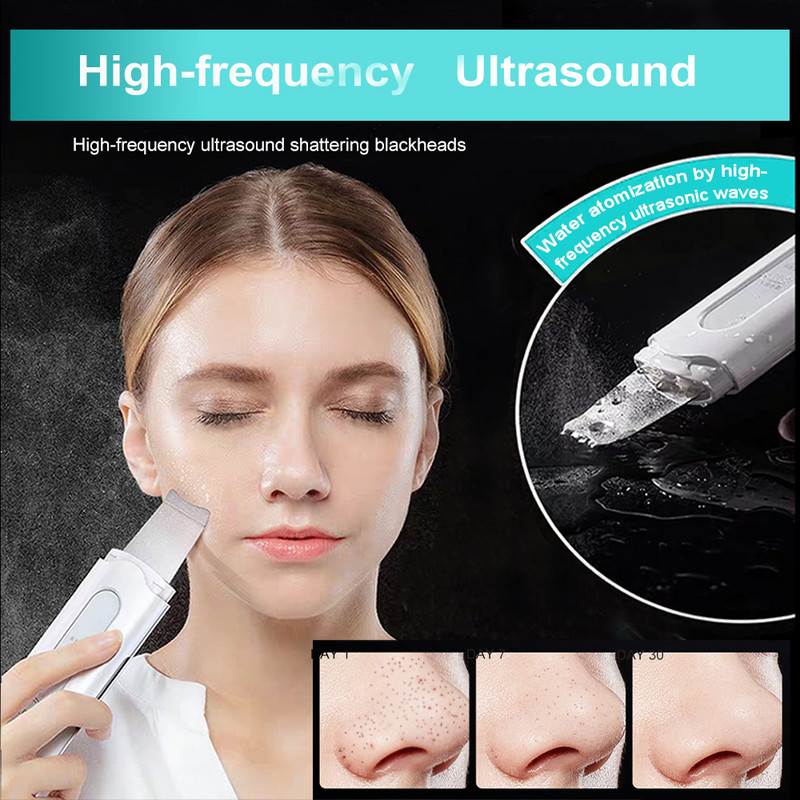 Ultrahangos bőrradír feketefej eltávolító mély arctisztító gép peeling lapát eltávolító arc pórusradír tisztító szépség