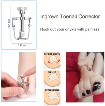 Επαγγελματικά εργαλεία πεντικιούρ Ingrown Tools Tools Kit Nail Care Ingrown Toenail Removal Correction Clippers Foot Care