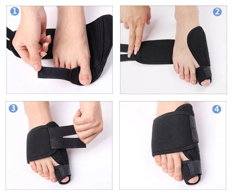 Soft Bunion Corrector Lábujjleválasztó Corrector Orvosi eszköz Lábujjkorrektor Hallux Valgus Lábápolás Pedikűr Ortotikus kezelés