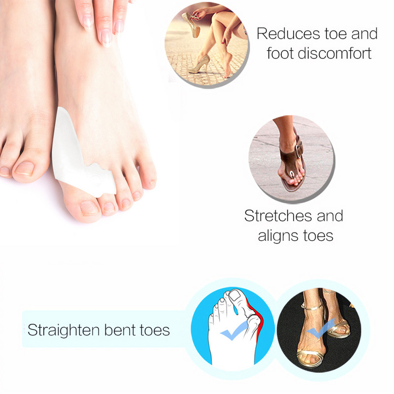 Soft Bunion Corrector Lábujjleválasztó Corrector Orvosi eszköz Lábujjkorrektor Hallux Valgus Lábápolás Pedikűr Ortotikus kezelés