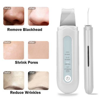 Skin Scrubber Deep Cleaning Face Scrubber Ultrasonic Skin Scrubber Deep Cleaning Face Scrubber Vibrating Face Cleansing Skin Spatula Peeling Beauty Instrument