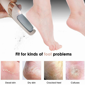 1 Σετ Ηλεκτρικά Εργαλεία Πεντικιούρ Λίμα Τακούνια ποδιών Αφαίρεση σκληρού ραγισμένου νεκρού δέρματος Αφαίρεση κάλλου Πόδια Καθαρό μηχάνημα Υγιεινή φροντίδα ποδιών