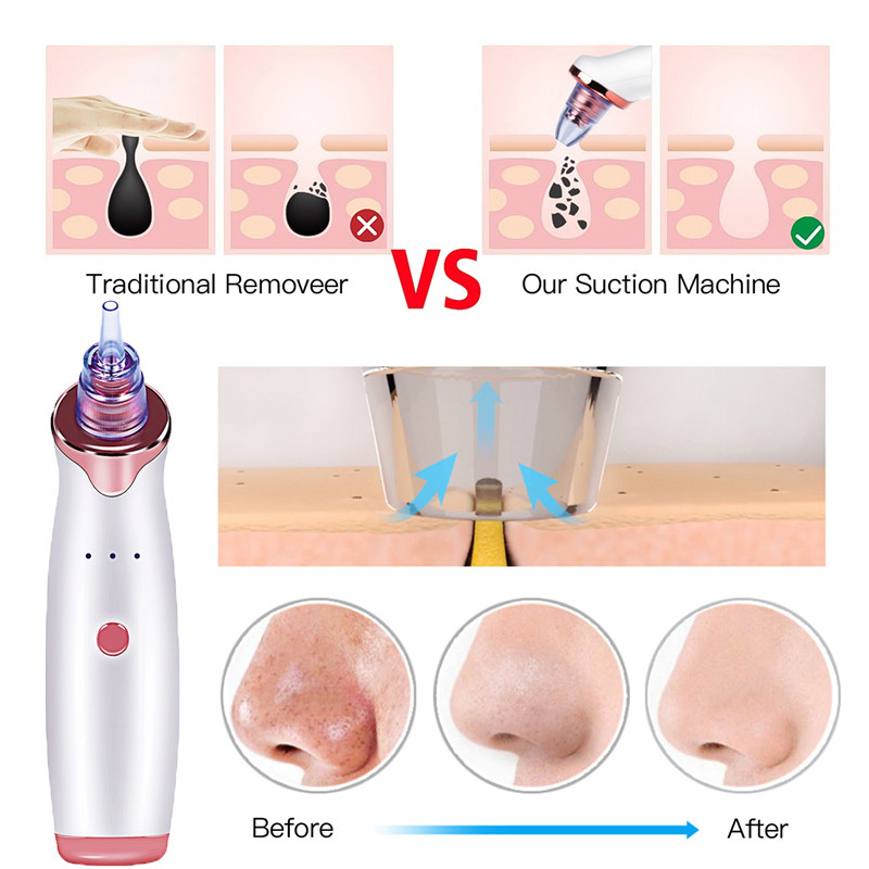 Pore Vacuum Mitesszer eltávolító Szívó Akne Peeling Pórusos Arctisztító Arc Bőrápolás Gyémánt mikrodermabráziós szépséggép