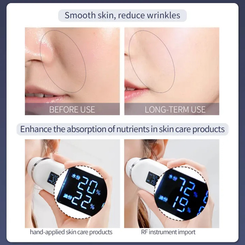 Hello Face Pulse EMS LED HIFU Beauty Machine hordozható második generációs Hifu otthoni arc ráncos állkapocs eltávolító kezelés