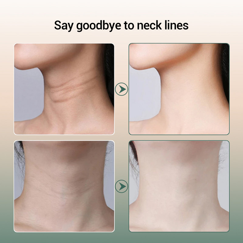 EMS Microcurrent Face Neck Beauty Device LED foton feszesítő fiatalító ránctalanító vékony dupla állú bőrápoló arcmasszírozó