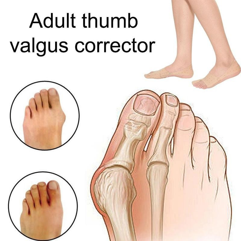 1 kom Separator nožnih prstiju Hallux Valgus udlaga Alat za pedikuru Korektor za čukljeve Stopala za njegu boli Kosti Ispravljač za palac Ortoza za pedikuru