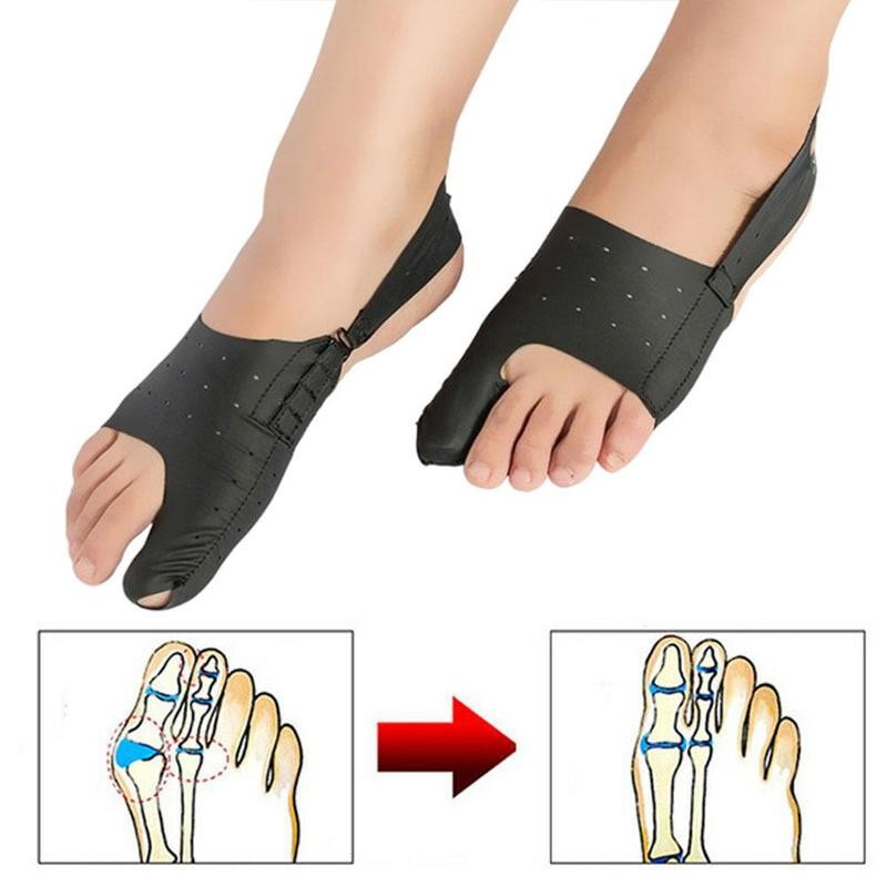 1 kom Separator nožnih prstiju Hallux Valgus udlaga Alat za pedikuru Korektor za čukljeve Stopala za njegu boli Kosti Ispravljač za palac Ortoza za pedikuru