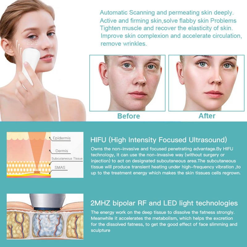 Ultrahangos Mini HiFu RF Facial Lifting Öregedésgátló Ránctalanító Bőrápoló SPA Beauty Device