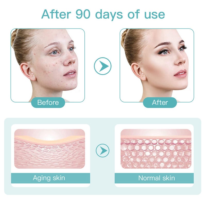 Ultrahangos Mini HiFu RF Facial Lifting Öregedésgátló Ránctalanító Bőrápoló SPA Beauty Device