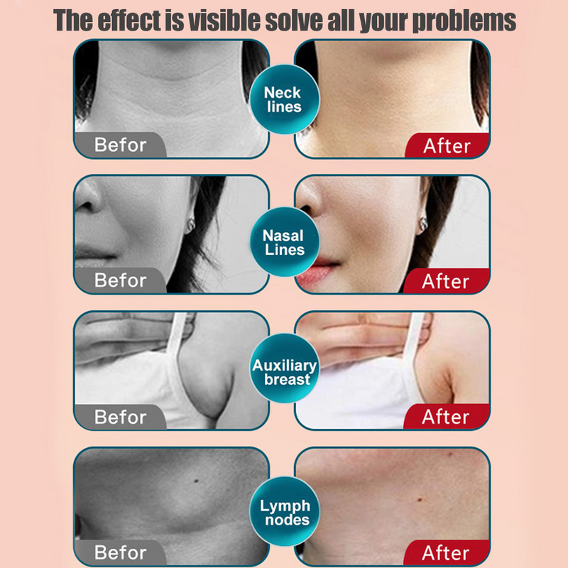 Gua Sha näoelektroonika näomasseerija RF kehasoojusmeridiaaniteraapia seade Värv valgus hifu mikrovool Naha ilu tervis