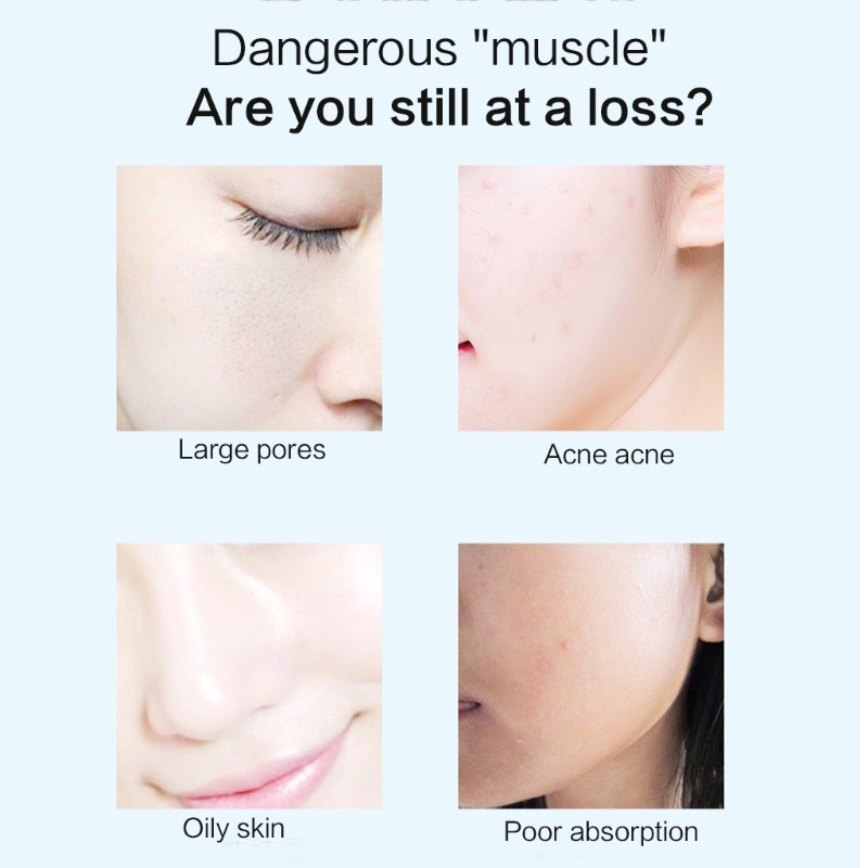 Aranyos macskamancs szilikon arcradír kézi arctisztító mélytisztító kefe sminkeltávolító mitesszer pórusradírozó eszköz