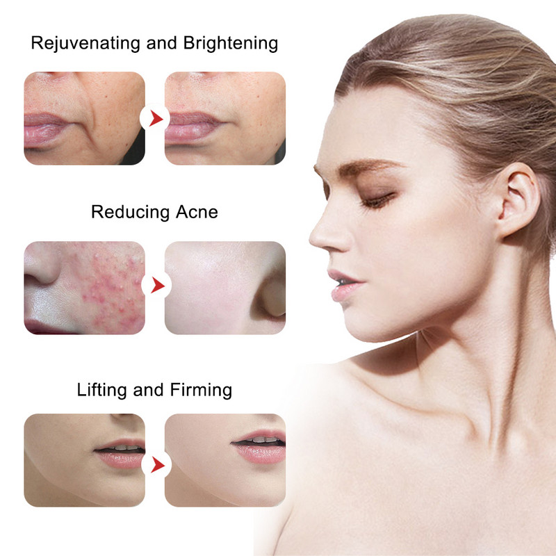 Ems Масажор за лице Звукова вибрация Лифтинг на лицето RF Машина за стягане на кожата Светлинна терапия против стареене Грижа за очите Грижа за очите Устройство за красота