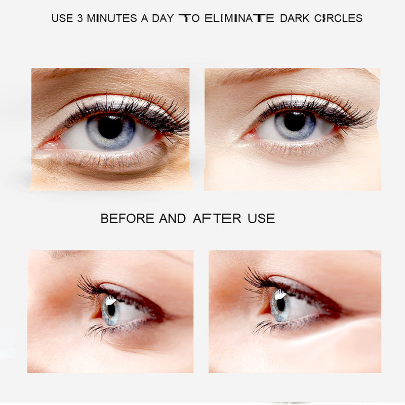 Terapija grijanjem Masažer za oči Ioni Električna vibracija Eye Lift Uređaj za ljepotu Anti-ageing Njega za uklanjanje bora pod tamnim krugovima