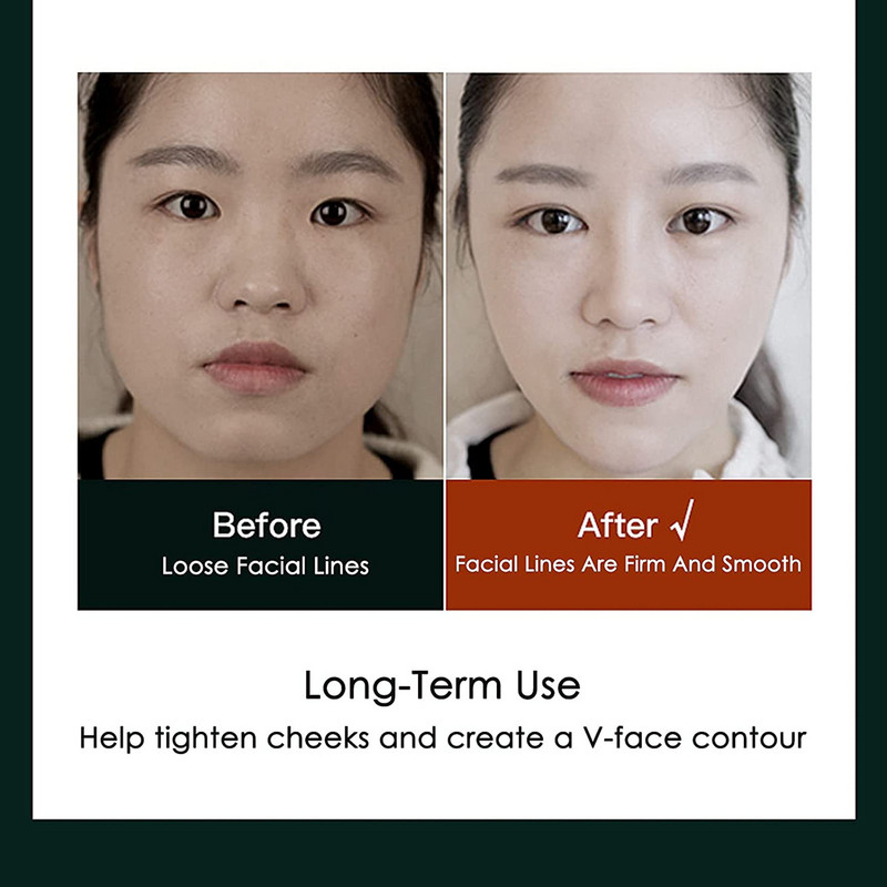 Elektrinis V formos veidą formuojantis masažuoklis, pakeliantis kaklą nuo raukšlių, raudonas mėlynas mėlynas dvigubas smakrą formuojantis grožio instrumentas su nuotolinio valdymo pulteliu